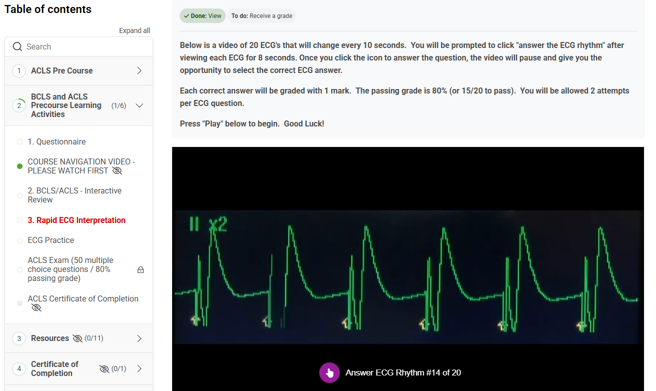 ECG